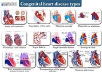Congenital Heart Disease Types, Causes, Symptoms,