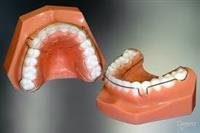 Dental  Braces and Retainers
