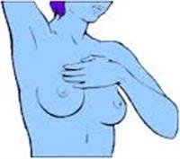 Breast Self-Examination - Topic Overview
