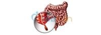 8 symptoms that require an appendix