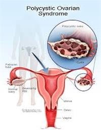Oral Cancers