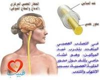 د. كلكتاوي: من الممكن أن تتزوج المرأة المصابة