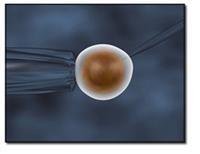 IVF and multiple pregnancy
