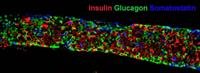 Stem cell-based therapy for type 2 diabetes