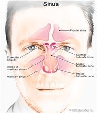 Sinus surgery facts