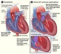 Congenital Heart Disease Directory