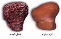 Suffering from forgetfulness? While you sleep,