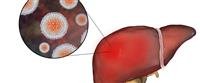 Surgical success of removing an enlarged spleen