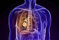 chronic obstructive pulmonary disease,
