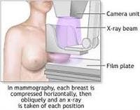 Mammograms