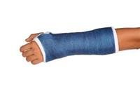 Broken Arm