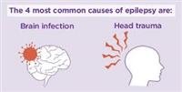 causes of epilepsy