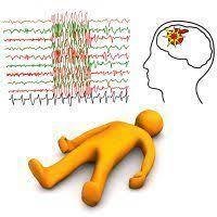 epilepsy.