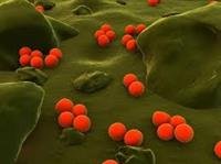 Gonorrhea - What Happens