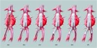 Endovascular Repair