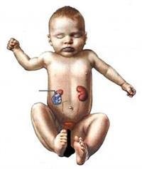 Symptoms and causes of kidney disease in children