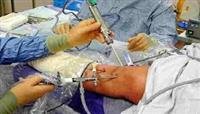 knee joint replacement