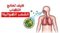 Treating bronchitis