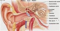 What causes otitis media and how is it diagnosed