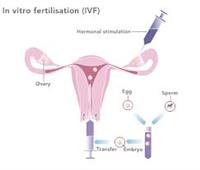 Infertility and In Vitro   Fertilization