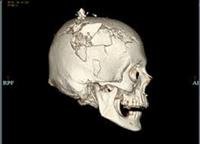 Medical Definition of Forensic medicine