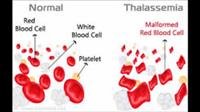 What Is Thalassemia?