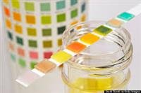 Urine Test