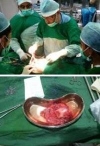 Rare surgery