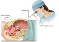 Minimally Invasive Surgery