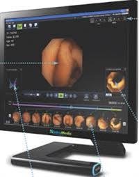 Video Capsule Endoscopy - Topic Overview