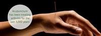 Acupuncture for Arthritis