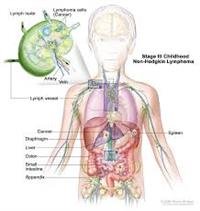 Late Effects of Treatment for  Childhood Cancer