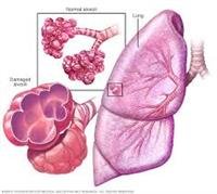 What Is Hospice Care?