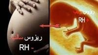ماذا يحصل للطفل عند اختلاف فصايل الدم للأبوين‎؟