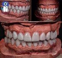 Dental allowances