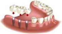 Prosthodontics
