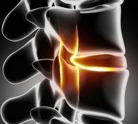 back disc,