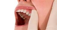 Problems With Dental  Fillings