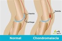 What’s Causing My Knee Pain?