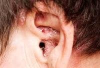 Why Do My Ears Itch