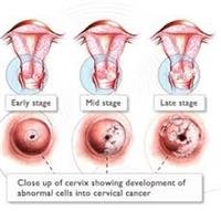 HPV and Pregnancy