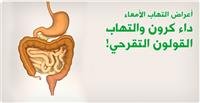 أعراض التهاب الأمعاء، داء كرون والتهاب القولون