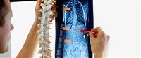 What You Need to Know About Organ Transplants