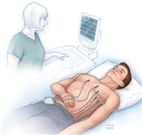 Electrocardiogram
