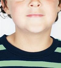 WHAT IS CENTRAL PRECOCIOUS PUBERTY (CPP)?