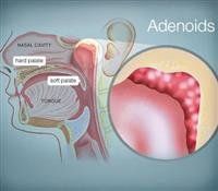 Discover 4 common causes behind