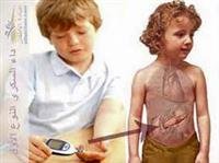 Doctor draws attention to rare digestive disease