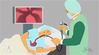 gastroscopy