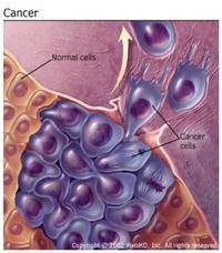 Understanding Leukemia -- the Basics