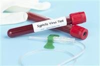 A dangerous virus that is transmitted from